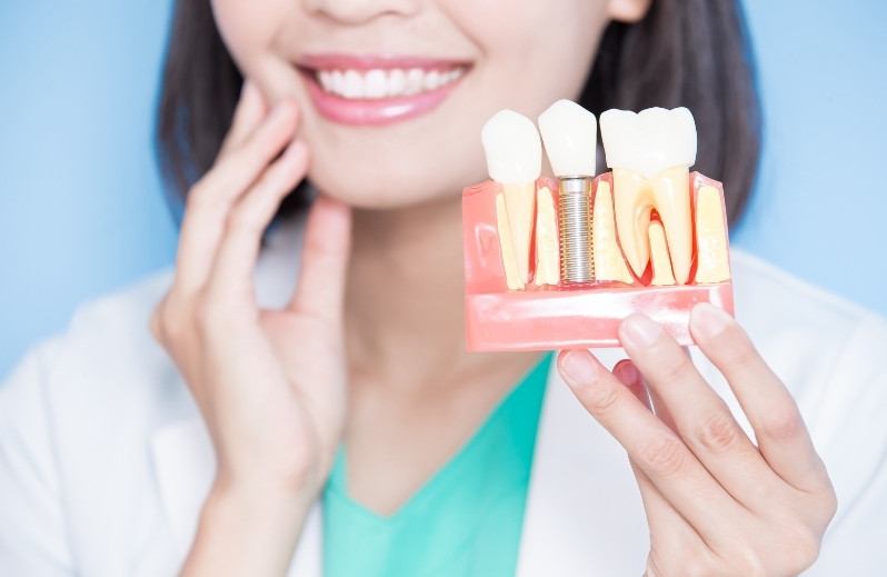 how dental implants are capable of improving your face shape